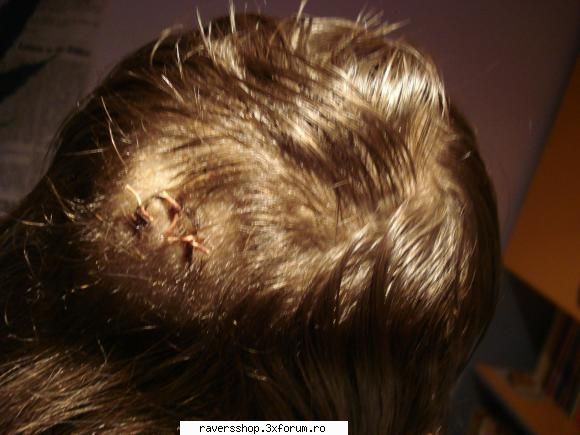 my scarred story!  :rotfl:  :rotfl: offtopic